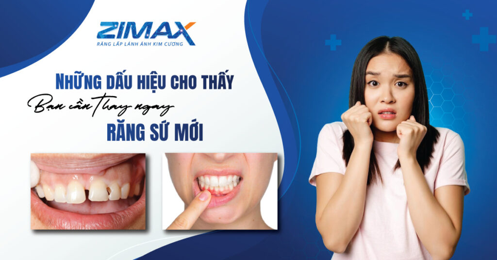Răng sứ bao lâu phải thay - Những dấu hiệu cho thấy bạn cần phải thay răng sứ mới