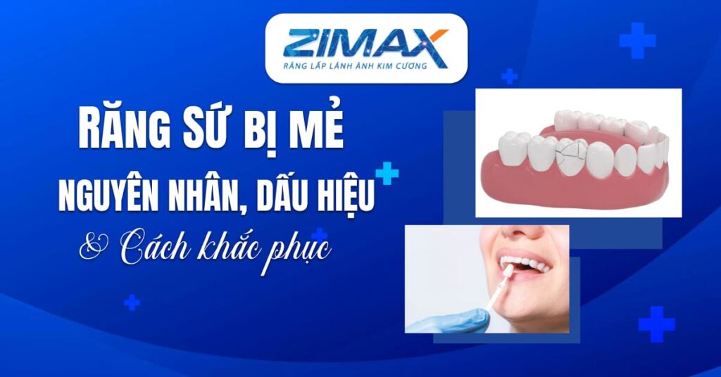 Răng sứ bị mẻ phải làm sao? Tìm hiểu nguyên nhân, dấu hiệu và cách khắc phục
