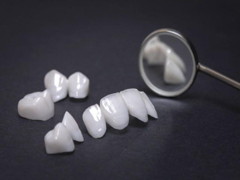Hiện nay có rất nhiều loại răng toàn sứ để khách hàng tham khảo và lựa chọn