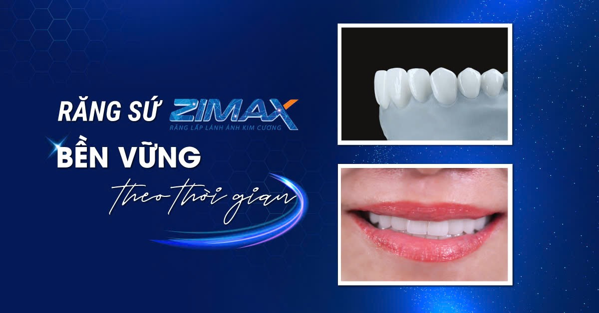 Răng toàn sứ Zimax: Lấp lánh ánh kim cương, bền vững theo thời gian