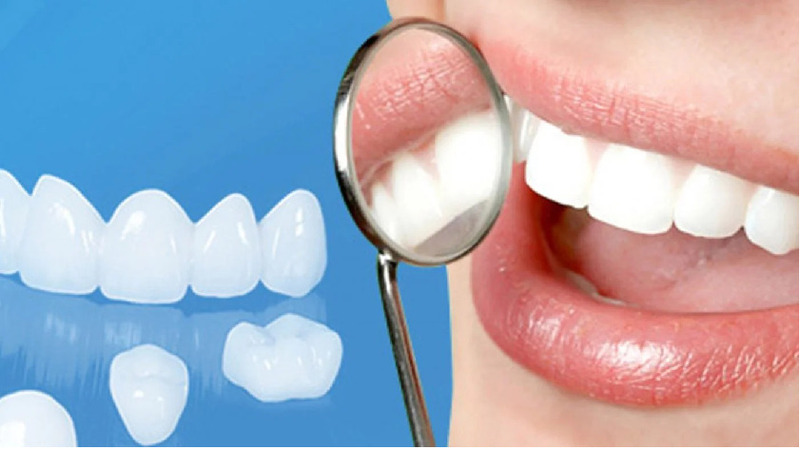 Thay thế mới đối với các trường hợp răng sứ gặp vấn đề nghiêm trọng 