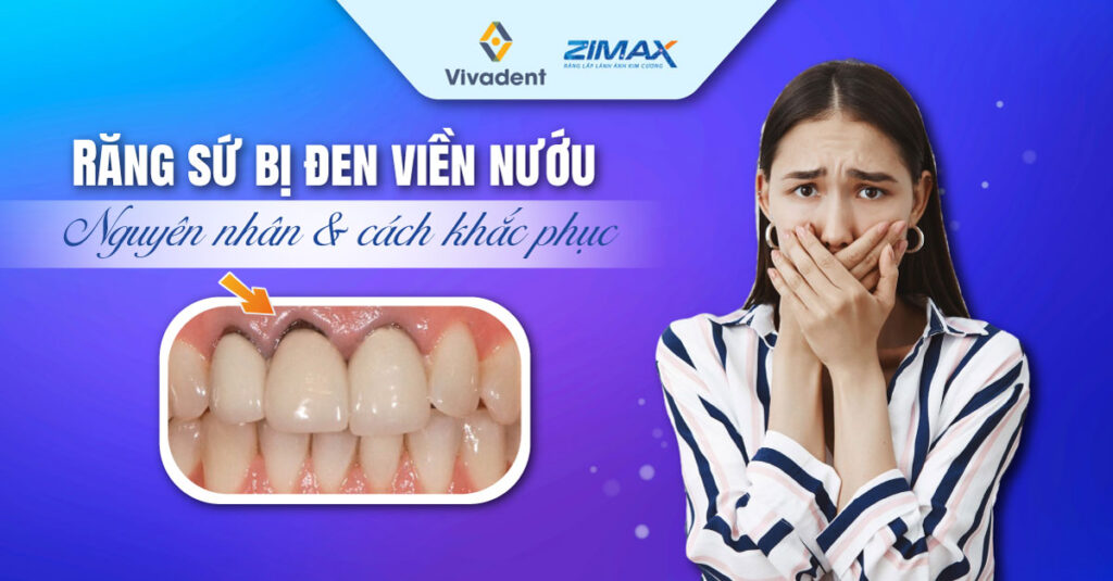 Răng sứ bị đen viền nướu: Nguyên nhân và cách khắc phục